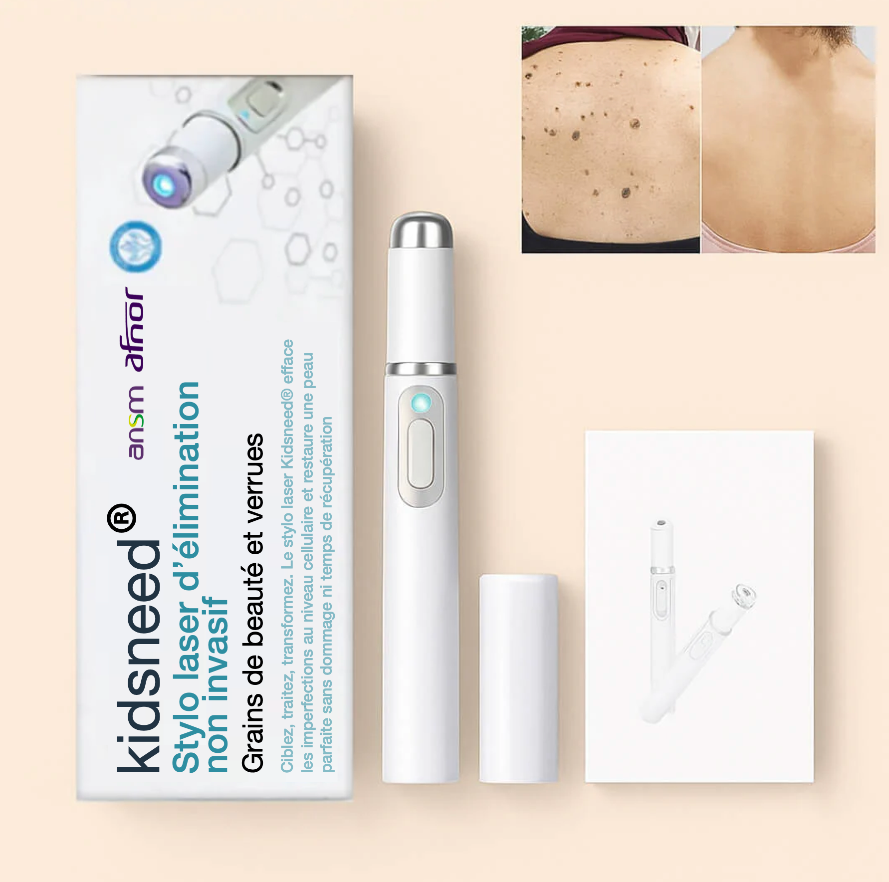 Kidsneed® Stylo Laser anti-imperfection